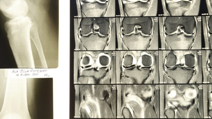 Oxígeno – Foto slider portada – Traumatologia